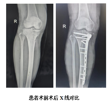 QQ截图20230609173207.png