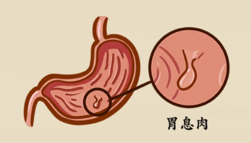 1713171961889065258.png 图片 1.png