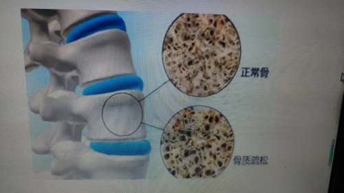 1716342957117054818.png 图片 6.png