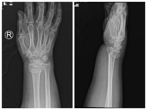 1757661060289062165.png 图片 2.png