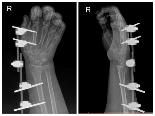 1757661067912038168.jpg 图片 3.jpg